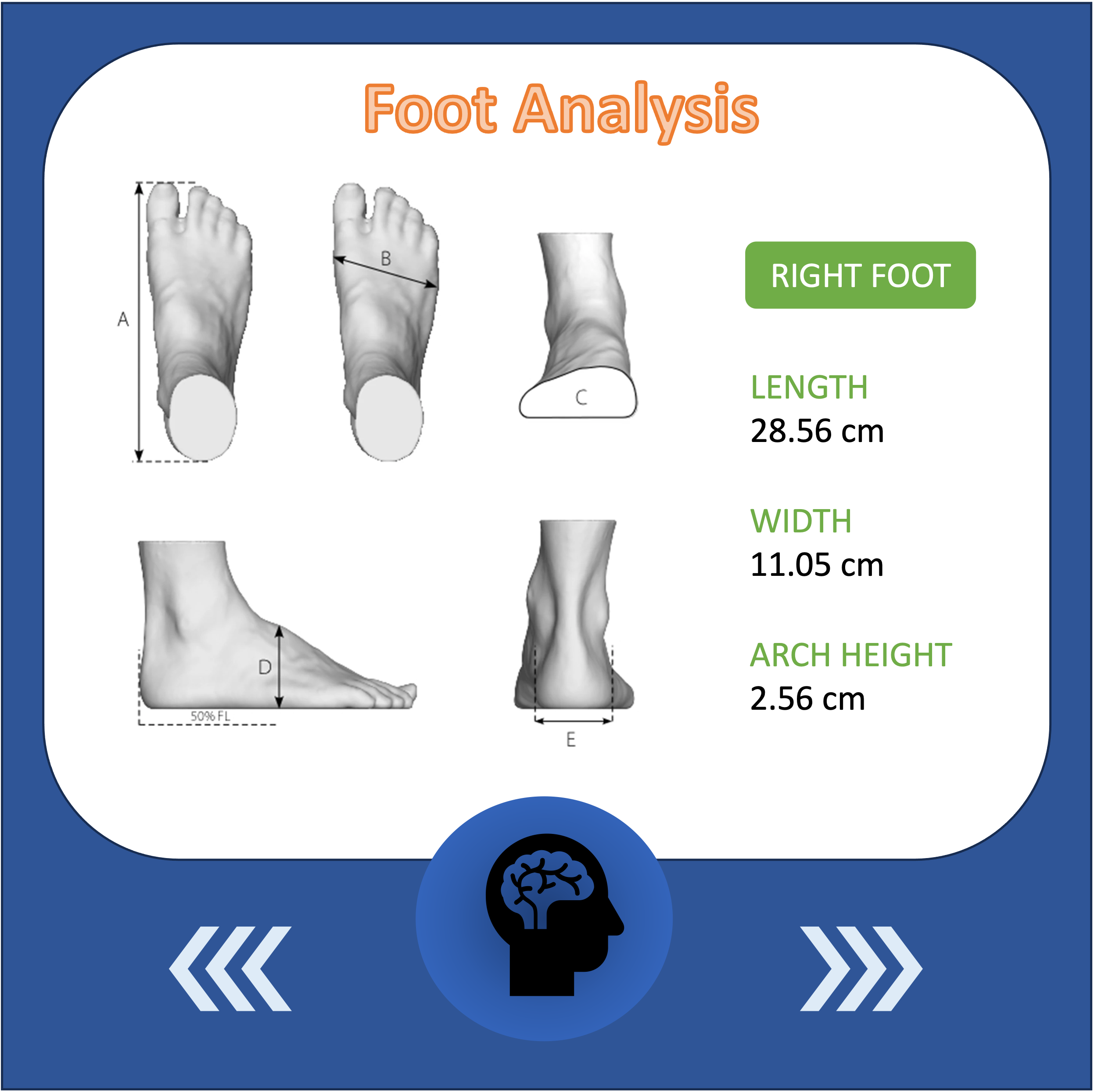 image of SprinSole custom orthotics foot analysis by experts